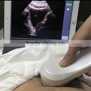 Sonostar New 3D 4D Laptop Ultrasound Scanner Ipad Ultrasound Scanner for Sale BProbe-2 thumbnail-2