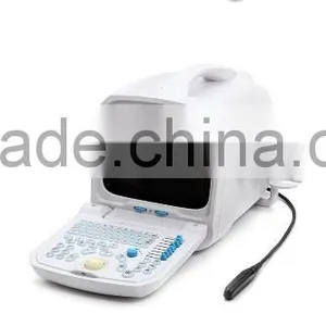 Lowe Price Medical Equipment Portable Cheap Ultrasound Scanner/Machine 3.5Mhz Multi-frequency Convex Probe thumbnail-2