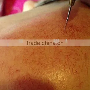 High Quality Equipment Best Mini 30.56MHz Vascular Removal Machine thumbnail-6