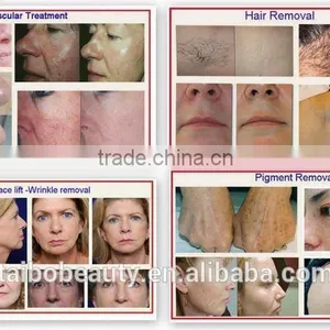 China Made Professional Portable Ipl Hair Removal Machine With CE Certification for Clinic and Beauty Spa thumbnail-4