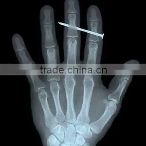 Medical X-ray Film Agfa Medical Dry Film for X-ray Machine Agfa Kodak Film thumbnail-3