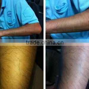 Top Quality Factory Price Laser Hair Removal Beauty Equipment thumbnail-4