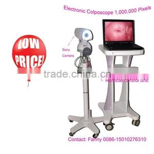 Digital High-Pixel Electronic Colposcope(RCS-500ii) With 1,000,000 Pixels thumbnail-1