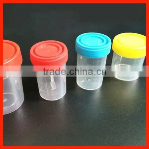 Urine Sterile Specimen Container for 60ml Bottles thumbnail-1