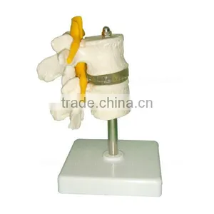Human Body Anatomy Spine Model Lumbar Vertebra thumbnail-3