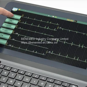 High Quality Diagnosis ECG Machine With 10.1 Inch Touch Screen thumbnail-5