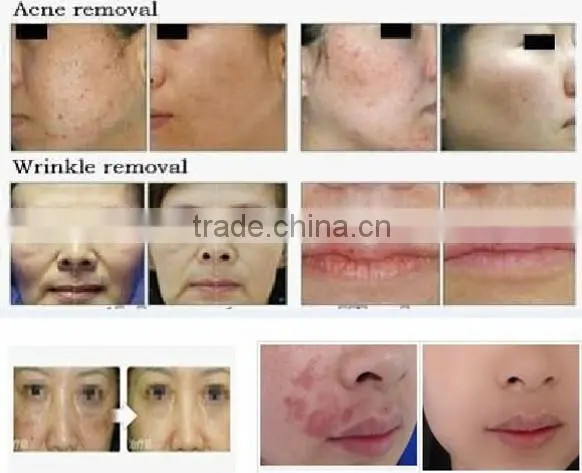 Best Low Price Co2 Laser Machine, Professional Low Price Co2 Laser Machine photo-6