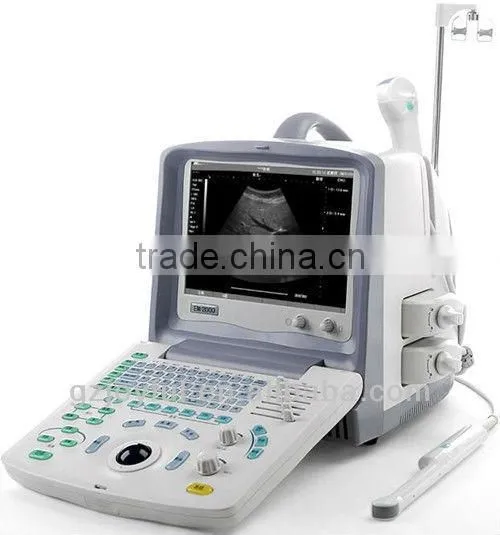 365 Frames Bidirectional Cine-loop Portable Ultrasound for Pregnancy