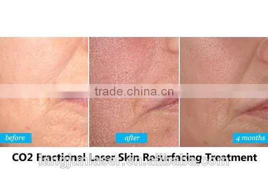 High Power 50w Co2 Laser Engraving and Cutting Machine photo-2