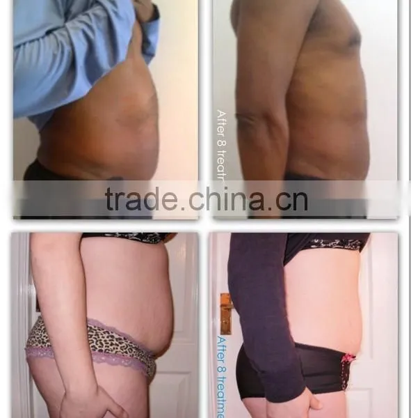 Skin Rejuvenation High Tech Rf Cavitation Body Slimming Machine/laser Cavitation Rf Vacuum Cavitation Slimming/fat Removal Focused Ultrasonic Skin Care photo-2