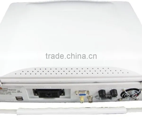 CE Approved Portable Ultrasound Scanner With 3.5Mhz Multi-frequency Convex Probe RUS-9000E photo-3