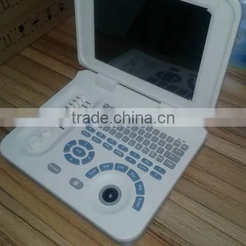 Portable Ultrasonic Diagnostic Devices , Laptop Portable Ultrasound Machine & Ultrasound Scanner photo-4