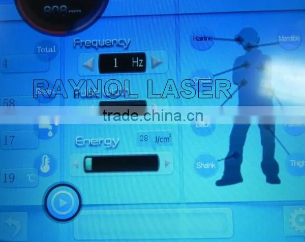 Color Touch Screen Hair Removal 808nm Laser Diode photo-2