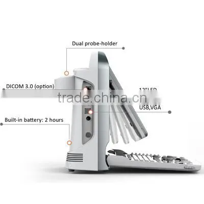 Portable Ultrasound Scanner Color Doppler Ultrasound System photo-3