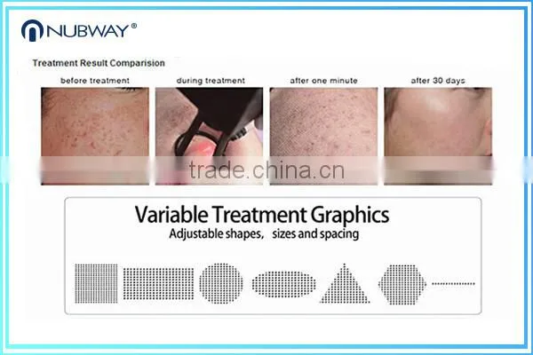 Skin Regeneration Stretch Mark Removal Hottest Sale !!!! Co2 Laser Remove Neoplasms 0.1-2.6mm Fractional Equipo Fractional Co2 Laser Acne Scar Removal Machine photo-3