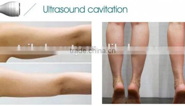 Professional High Intensity Focused Ultrasound Therapy Beauty Machine Weight Loss Machine Fat Burning Instrument photo-5