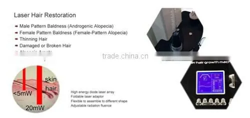 Non-invasive No Side Effect No Scar Laser Hair Removal Machine Price photo-5