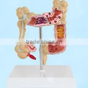 Factory Direct Supply Model of Human Large Intestinal Disease Model of Human Organs Anatomical Medical Models