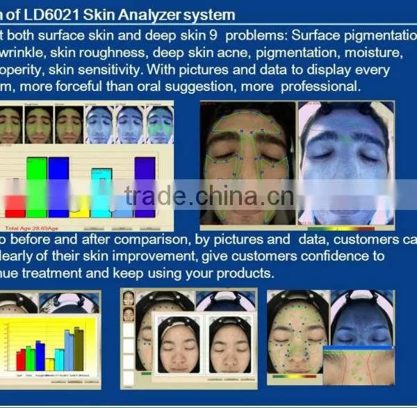 2016 HOT SELL Spanish 3d Nls Skin Health uv Analysis Machine