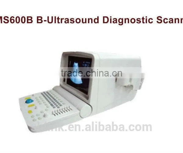 Top Grade Hotsale Link Digital Non-Interlaced Portable Ultrasound Scanner 200D With Low Price photo-5