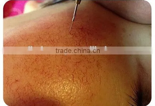 2016 Professional Mini High Frequency Spider Vein Removal/ Vascular Removal/thread Vein Removal photo-5