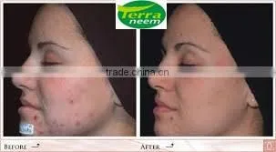 HIGH PURE COLD PRESSED TERRA NEEM OIL FROM INDIA photo-5