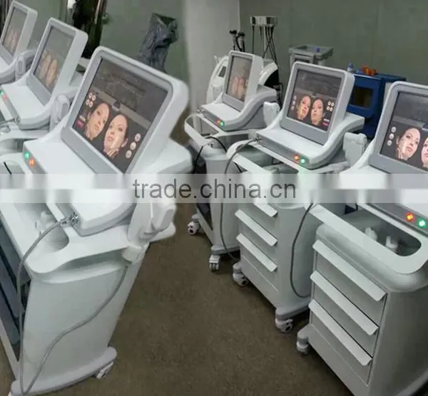 High Intensity Focus Ultrasound HIFU for Face and Neck Lift Without Surgery photo-4