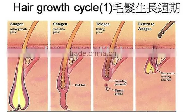 Manufactory Vertical Pain Free Shr /ipl Hair Removal Equipment& Machine photo-6