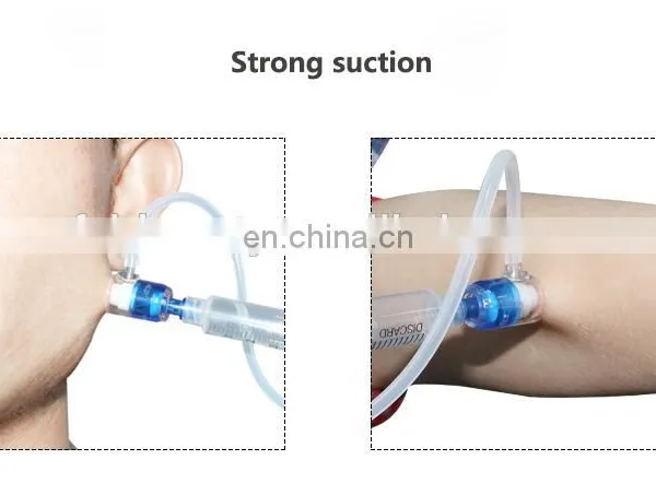 Portable EZ Water Mesotherapy Injector Korea Mesotherapy EZ Negative Pressure Mesogun for Water Injector photo-2