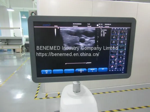 Trolly 2D Echocardiography Color Doppler Ultrasound Scanner Diagnosis Equipment photo-4