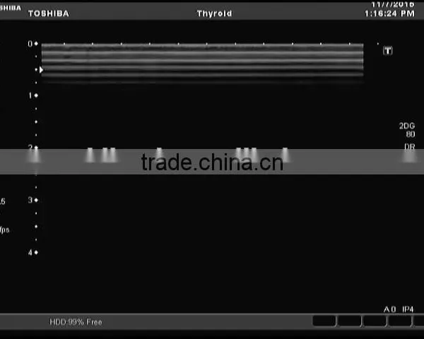 Used Toshiba Ultrasound Linear Probe PLT-805AT Doppler Color Transducer photo-4