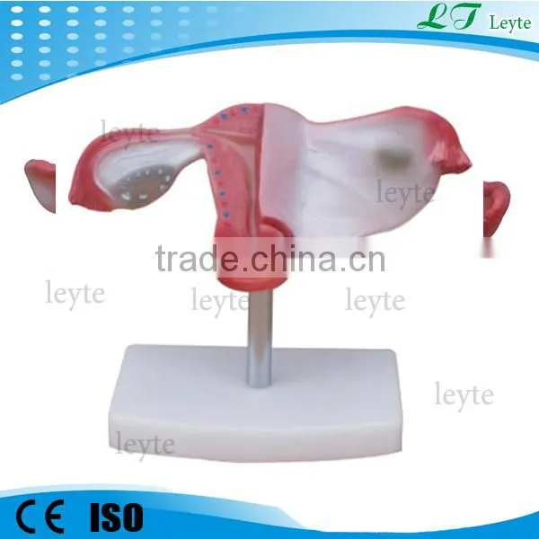 XC-436 Human Anatomical Uterus Model
