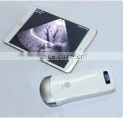 UltraSound Scanner, Convex Probe Ultrasound Scanner, WiFi, 3.5MHz / R40 / 64 Elements, SIFULTRAS-5.1 photo-4
