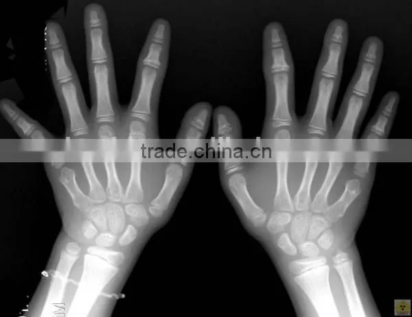 Agfa Hns Film, Agfa Film Dt2b for X-ray Radiography Scanner