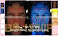 Boxy Skin and Hair Analyzer Scope 3D Portable Skin Analyzer for Skin Testing photo-3