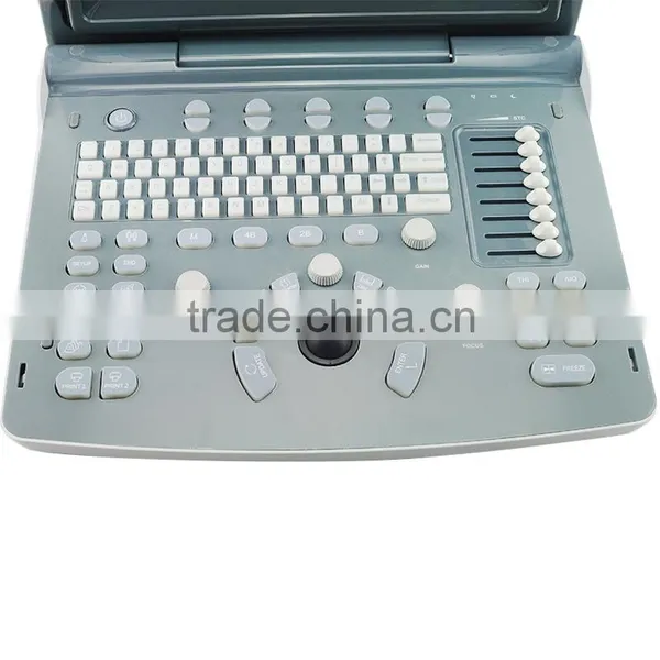 NEW Ultrasound Scanner ECO1 With 2.5-5.0MHz Convex Probe for Abdoment OB GYN Urology Vascular Small Parts Pediatrics Cardiology photo-5
