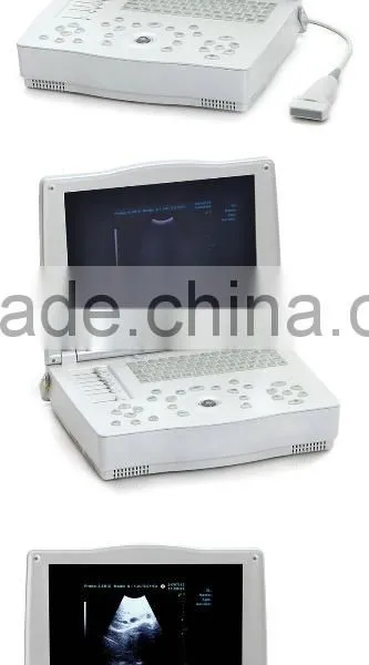 Hospital Clinical Equipment 15-inch Full Digital Laptop Ultrasound Scanner China Made Portable Ultrasound Machine photo-2