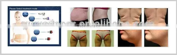 Rf Slimming Machine Hot Sale 7 In On Multifunctional Ultrasound Cavitation&RF Machine /Cavitation RF Machine/body Slimming Cellulite Reduction photo-4