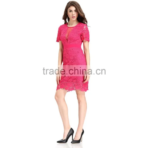 Fashion Lace Patchwork Short Frock Lady Image Skater Dress photo-4
