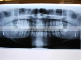China Medical x Ray Dental Film With ISO 13485 and CE