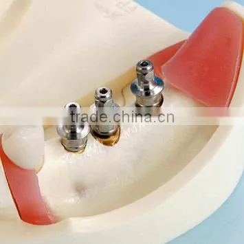 Typodont Orthodontic Model for Practicing Teeth Model Factory photo-2