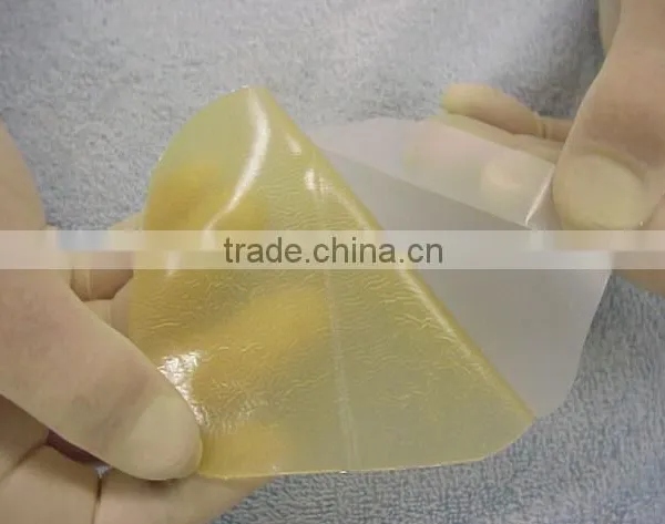 Hydrocolloid Wound Dressing for Wound Treatment photo-4