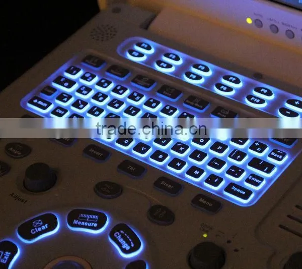 Hot Sale Color Doppler Ultrasound Machine for Sale photo-5