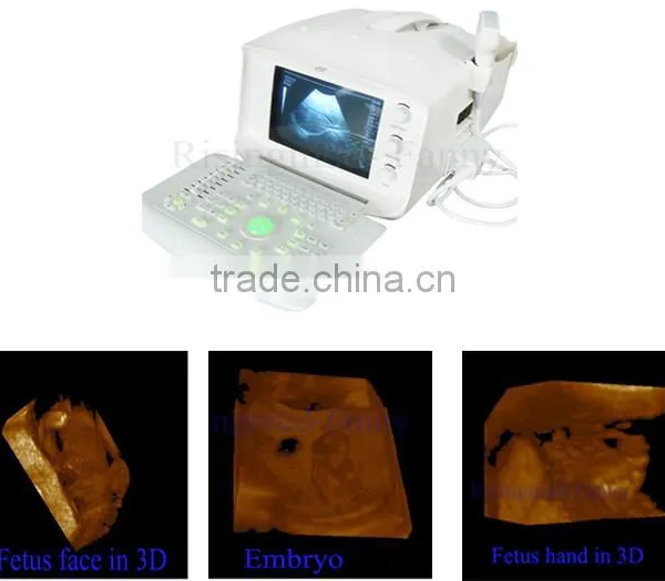 Promotion!!CE Approved Notebook USB Ultrasound Scanner With 3.5Mhz Multi-frequency Convex Probe RUS-6000A photo-2