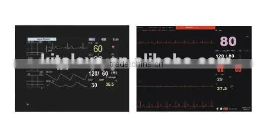 Multiparameter Ambulance Patient Monitor photo-6