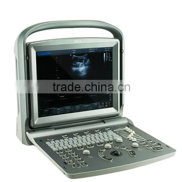 China Cheap Price USB Portable Laptop Color Doppler Ultrasound Scanner for Pregnancy Scanner Ultrasound photo-4
