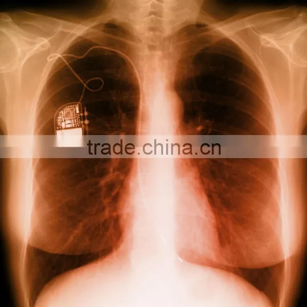 Medical Thermal x Ray Film,medical Thermal Dry Film ,medical Lab Analyzers