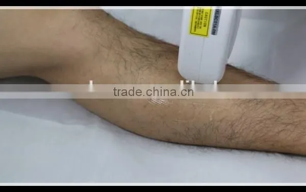 2015 Hot Vertical 808nm Diode Laser / Diode Laser Hair Removal / 808 Permanent Hair Removal photo-6