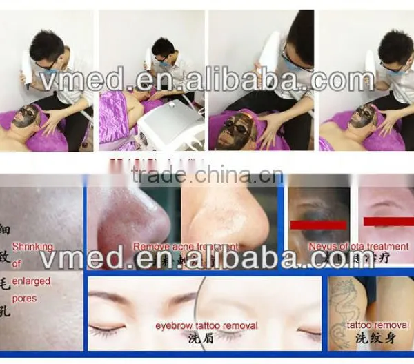 2016 Medical Aesthetic Equipment Tattoo Removal Machine photo-6