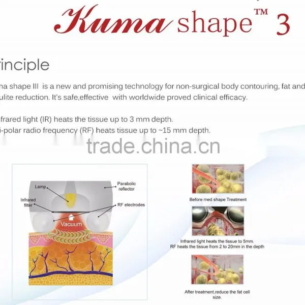 Highly Spoken Kumashape III IR RF Vacuum Pressure Body Contour Body Massage Equipment photo-3